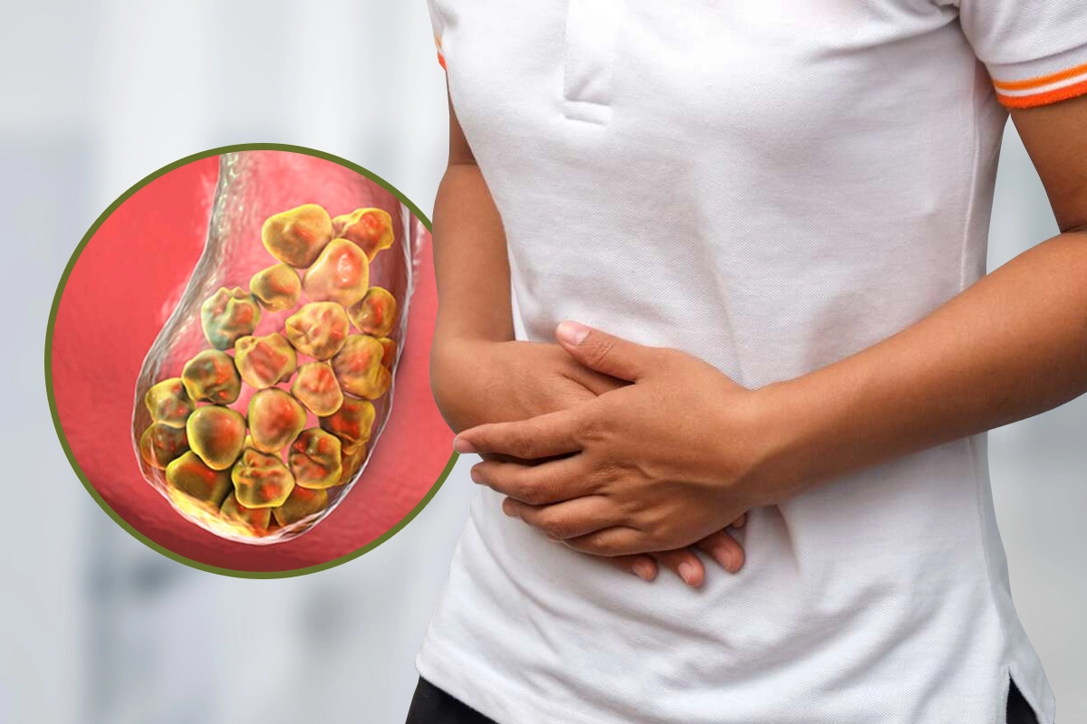 Cirugía de Vesícula | Dr. Saúl Echeverría – Cirujano general y laparoscópico en El Salvador